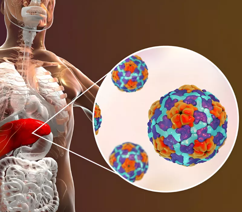 Hepatites virais
